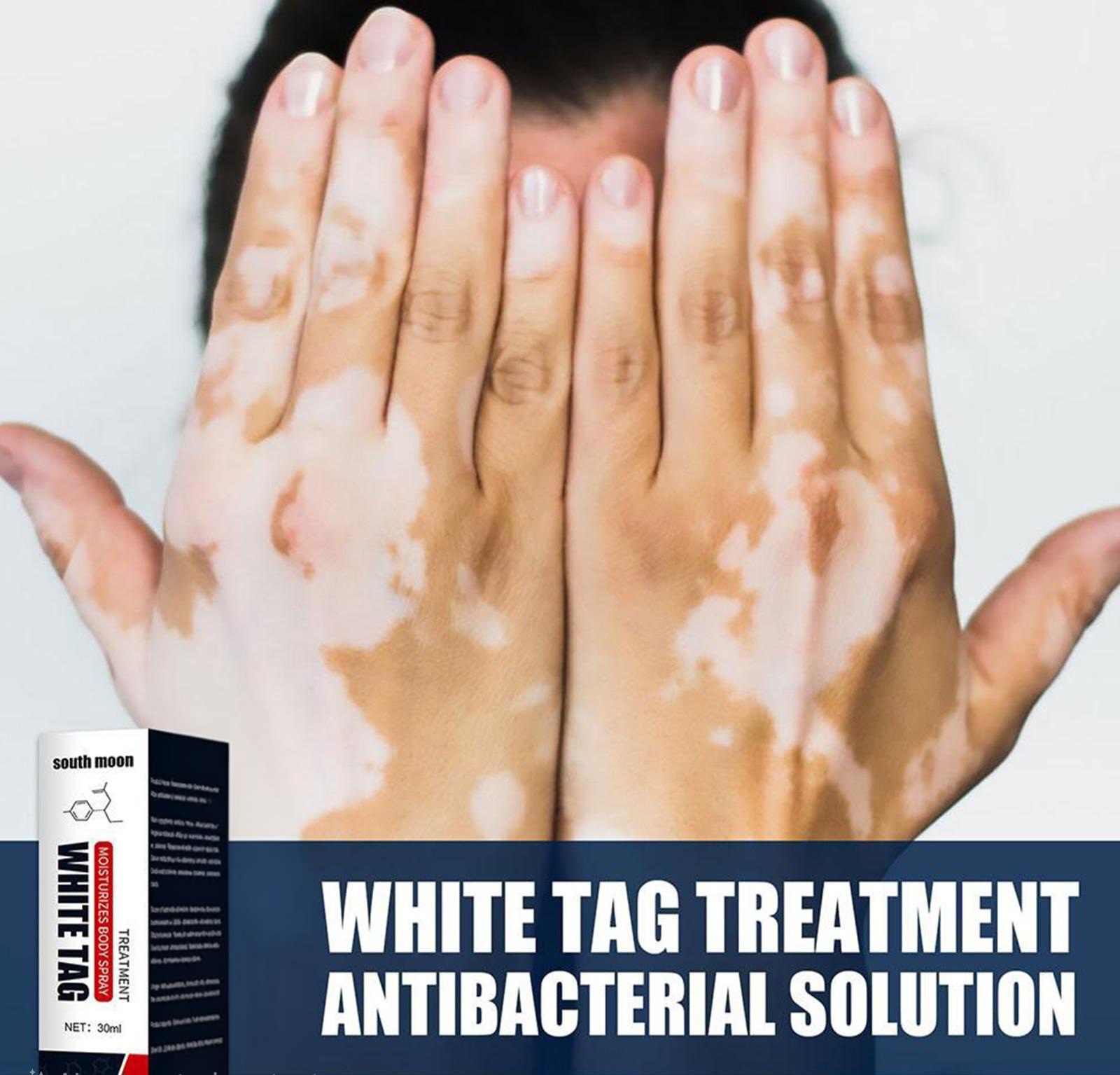 S44b938195cb64cf89f1ce15d930eb4e1X(1)